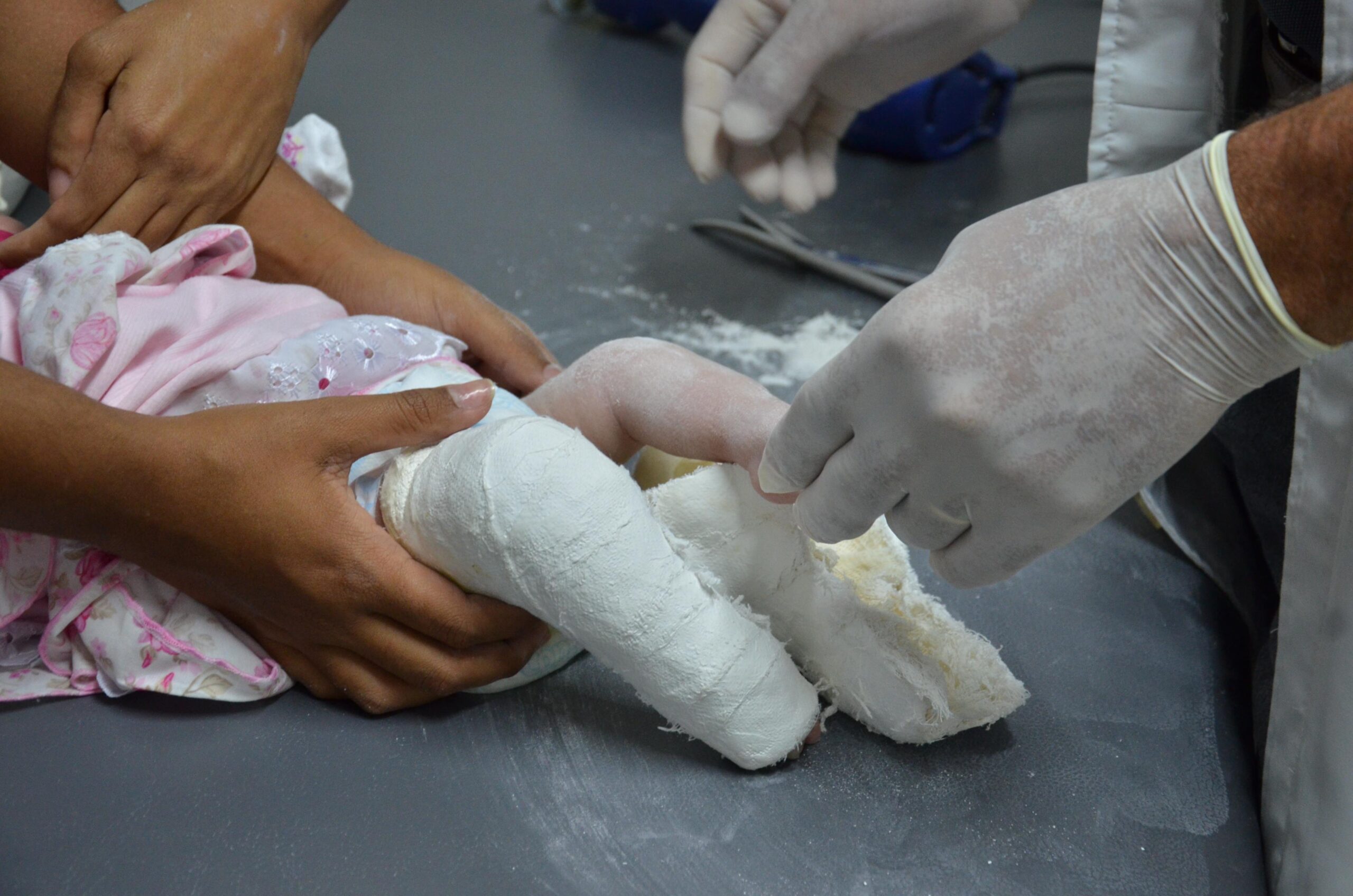 Prefeitura de Campina Grande abre ambulatório de ortopedia pediátrica no Hospital da Criança