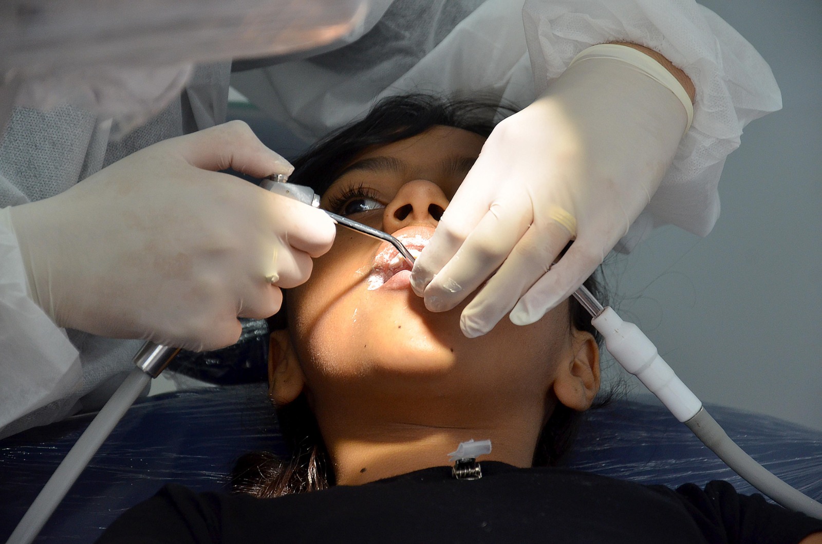 Secretaria de Saúde realiza mutirão de cirurgias odontológicas para crianças e pessoas com deficiência nesta sexta-feira no CEO do Catolé